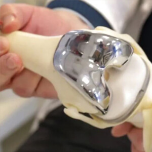 Manitoba pumps $5.3M into boosting hip, knee, cataract surgeries, reducing wait times